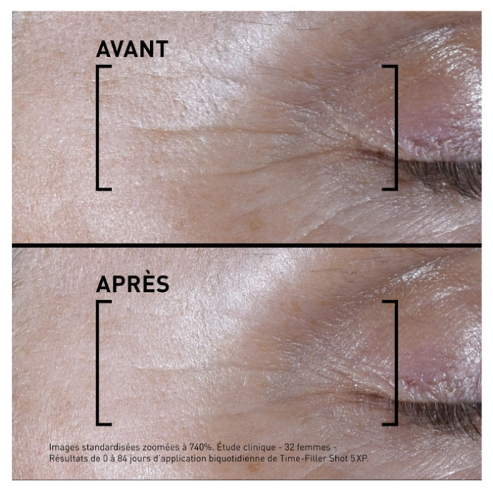 Filorga Time-Filler Shot 5XP Konzentriertes Anti-Aging-Serum 15ml