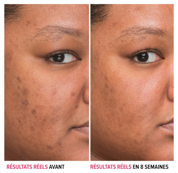 IT Cosmetics Bye Bye Dark Spots Sérum anti-taches à la niacinamide pour peaux hyperpigmentées 30ml