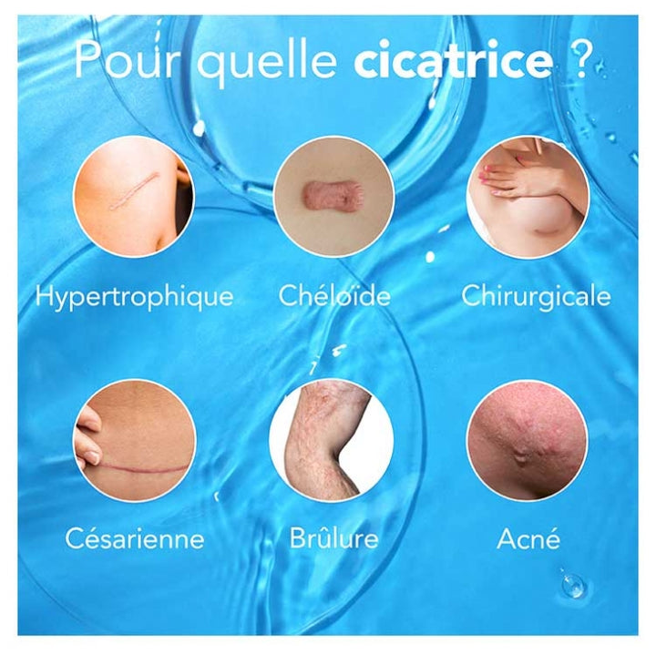 Kelo-cote Scar Repair Gel 30g (1.06oz)