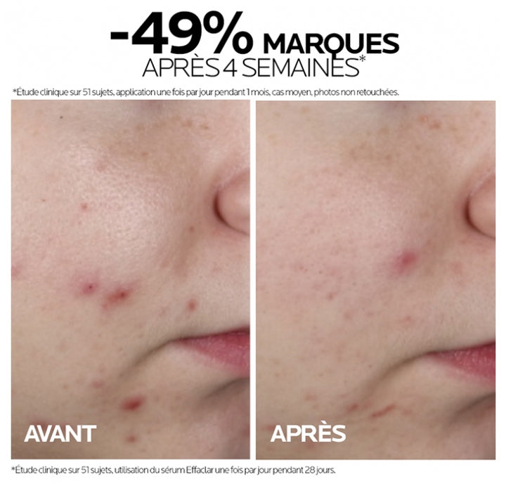 La Roche-Posay Effaclar Blemish Control Face Serum acne-prone skin 30ml (1.01fl oz)