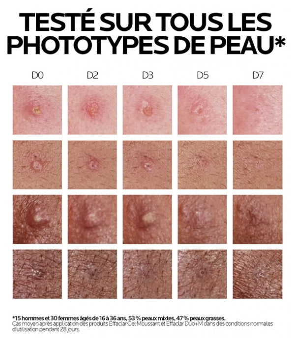 La Roche-Posay Effaclar Duo+M Korrigierende Anti-Pickel Gel-Feuchtigkeitspflege 40ml