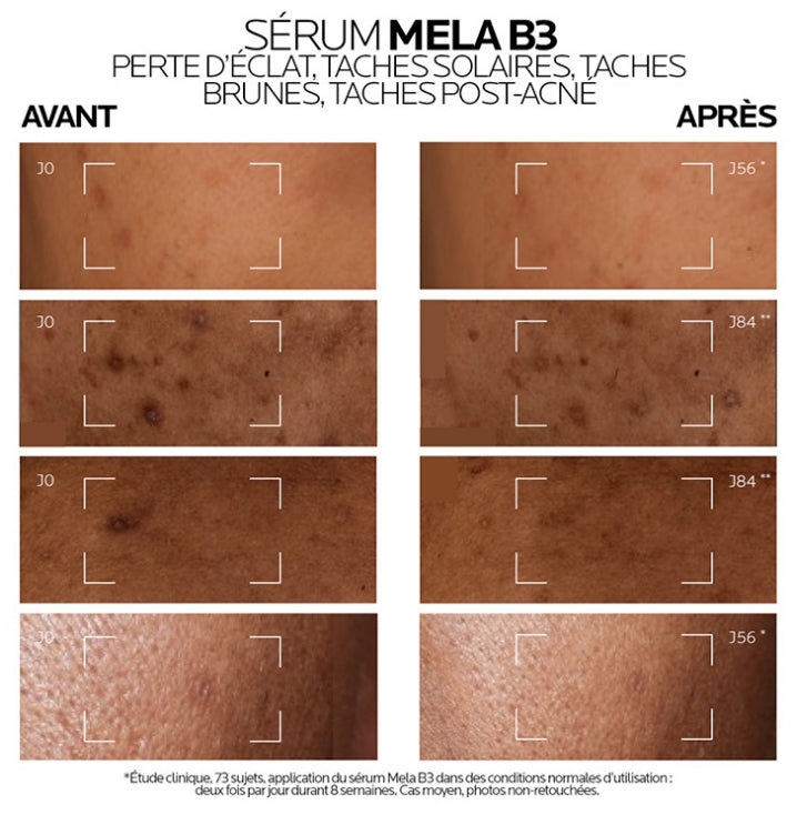 La Roche-Posay Mela B3 Concentrato intensivo antimacchie anti-ricomparsa 30ml