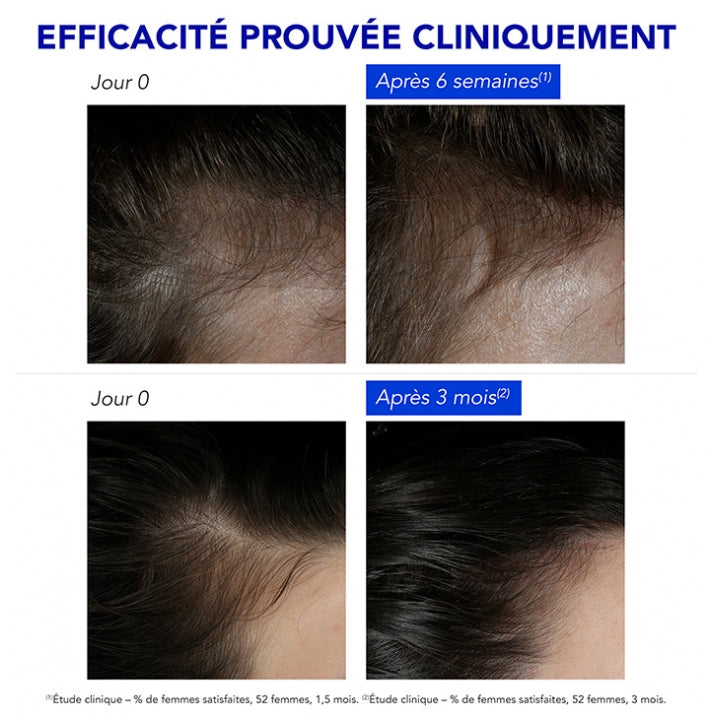 Phyto Paris Phytophanere Reactive Hair Loss Treatment 12 ampoules