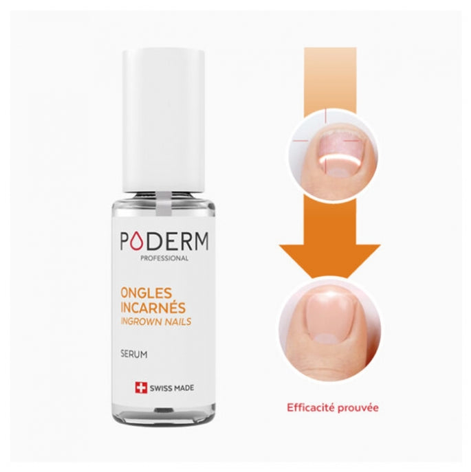 Poderm سيروم زيتي مهدئ للأظافر الحساسة 8ml