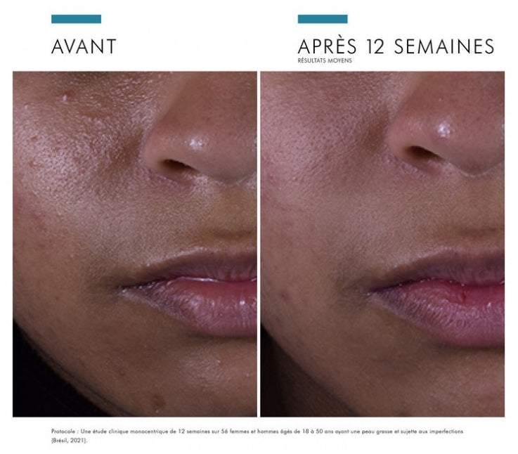 Skinceuticals Silymarin CF Sérum facial preventivo anti-imperfecciones 30 ml