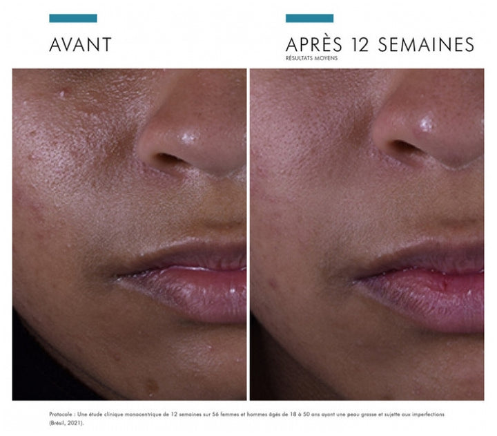 Skinceuticals Silymarin CF Sérum facial preventivo anti-imperfecciones 30 ml