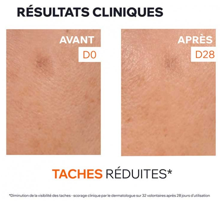 Uriage Depiderm سيروم معزز للإشراقة ومضاد للبقع الداكنة 30ml