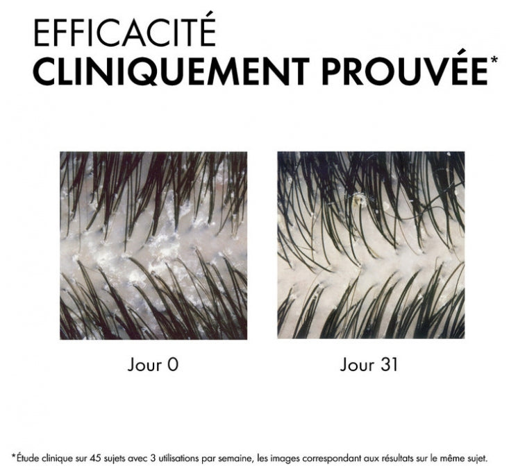 Vichy Dercos Anti-Dandruff DS Shampooing pour cheveux normaux à tendance grasse